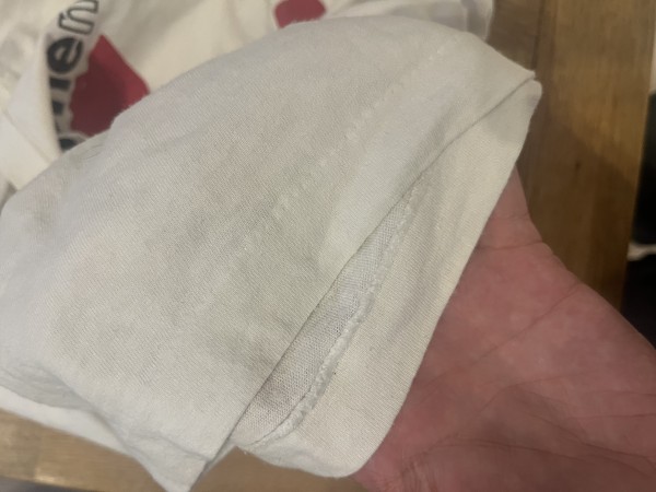 Arm