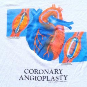 Vintage 1989 Coronary Angioplasty White T-Shirt L