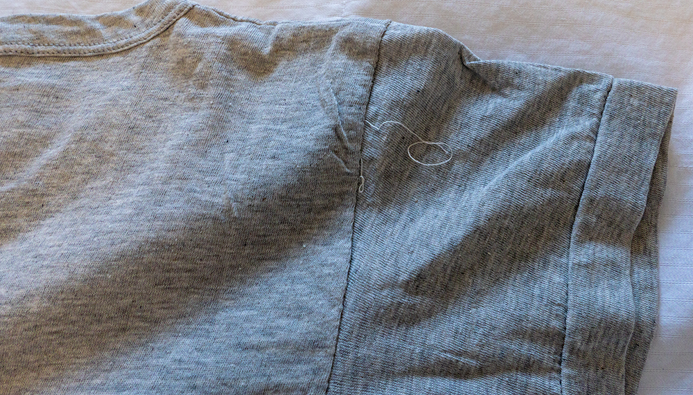 arm excess thread